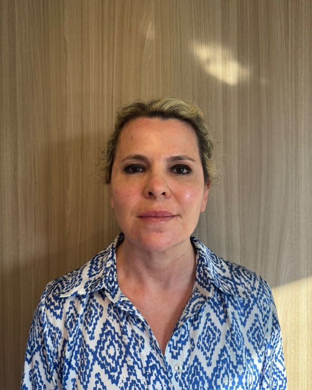 Depois — Embelezamento Facial
